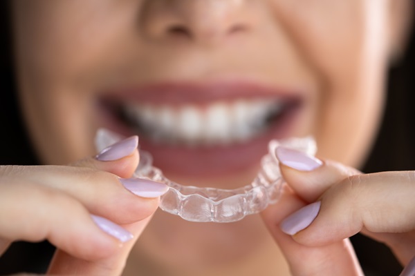 FAQs About Clear Aligners