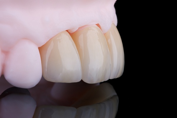 Why You May Need A Dental Crown After Root Canal Therapy