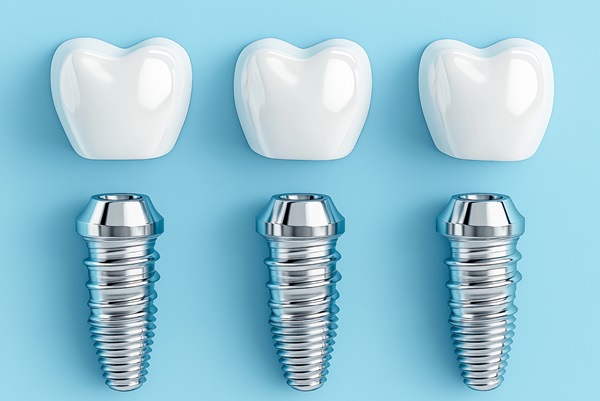 Are Dental Implants Safe?